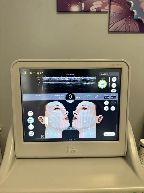 2021 Ulthera Ultherapy Ultrasound Skin